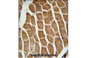 CTTB2 Antibody (N-term) (ABIN651681 and ABIN2840358) immunohistochemistry analysis in formalin fixed and paraffin embedded human skeletal muscle followed by peroxidase conjugation of the secondary antibody and DAB staining.