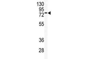 Western blot analysis of TLK2 antibody and mouse testis tissue lysate. (TLK2 anticorps  (AA 141-171))