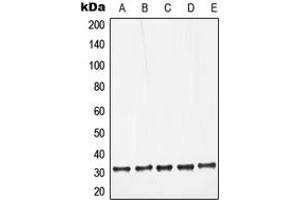 Western blot analysis of Galectin 3 expression in HeLa (A), Jurkat (B), Raw264. (Galectin 3 anticorps  (Center))