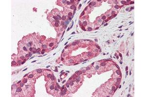 Immunohistochemistry (IHC) image for anti-Pentraxin 3 (PTX3) (N-Term) antibody (ABIN2786737)