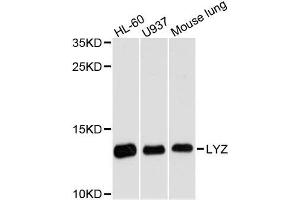 Western blot analysis of extracts of various cell lines, using LYZ antibody. (LYZ anticorps  (AA 1-100))