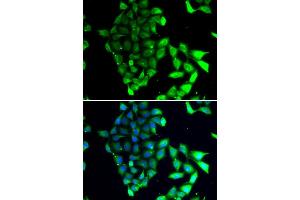 Immunofluorescence analysis of MCF7 cell using MID1 antibody. (MID1 anticorps)