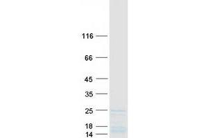 Validation with Western Blot