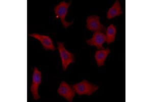ABIN6264519 and ABIN6273013 staining HepG2 by IF/ICC.