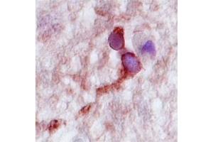 Human Hippocampus; CPLX2 antibody - N-terminal region in Human Hippocampus cells using Immunohistochemistry (CPLX2 anticorps  (N-Term))