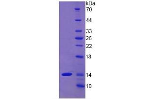SDS-PAGE of Protein Standard from the Kit  (Highly purified E. (ALT Kit ELISA)