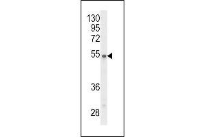 Western blot analysis of P2R3C Antibody (N-term) (ABIN653699 and ABIN2843017) in Y79 cell line lysates (35 μg/lane).