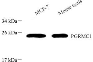 Western blot analysis of PGRMC1 (ABIN7075182) at dilution of 1: 800 (PGRMC1 anticorps)