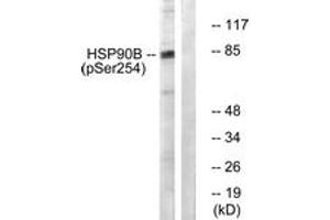 Western blot analysis of extracts from HeLa cells treated with TNF-a 10ng/ml 30', using HSP90B (Phospho-Ser254) Antibody.