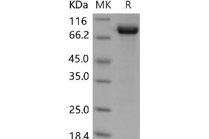 Western Blotting (WB) image for Discoidin Domain Receptor tyrosine Kinase 1 (DDR1) protein (Fc Tag) (ABIN7320132) (DDR1 Protein (Fc Tag))