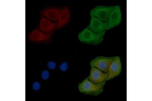 ABIN6258385 and ABIN6274982 staining Hela cells by IF/ICC.