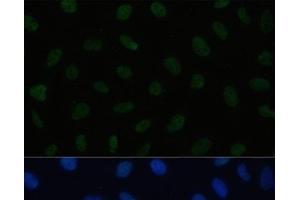 Immunofluorescence analysis of U2OS cells using HSF1 Polyclonal Antibody at dilution of 1:100. (HSF1 anticorps)