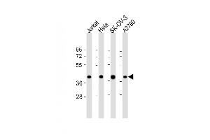 All lanes : Anti-GBGT1 Antibody (Center) at 1:2000 dilution Lane 1: Jurkat whole cell lysate Lane 2: Hela whole cell lysate Lane 3: SK-OV-3 whole cell lysate Lane 4:  whole cell lysate Lysates/proteins at 20 μg per lane.