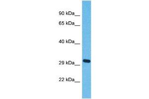 Western Blotting (WB) image for anti-Olfactory Receptor, Family 5, Subfamily J, Member 2 (OR5J2) (C-Term) antibody (ABIN2791758) (OR5J2 anticorps  (C-Term))