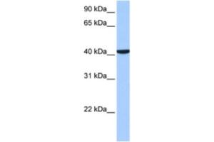 Western Blotting (WB) image for anti-Coiled-Coil and C2 Domain Containing 1B (CC2D1B) antibody (ABIN2463517) (CC2D1B anticorps)