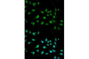 Immunofluorescence analysis of MCF7 cell using BMPR1B antibody. (BMPR1B anticorps  (AA 1-126))