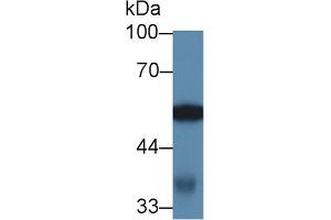 Detection of ABAT in Mouse Kidney lysate using Polyclonal Antibody to 4-Aminobutyrate Aminotransferase (ABAT)