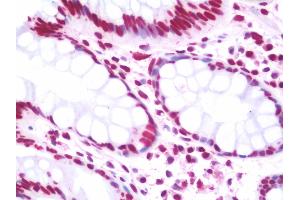 Anti-CSB / ERCC6 antibody IHC staining of human colon.