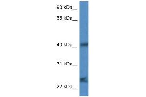 WB Suggested Anti-Scamp1 Antibody Titration: 1. (SCAMP1 anticorps  (N-Term))