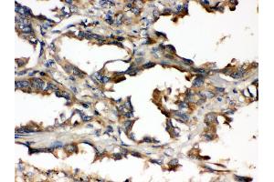 Immunohistochemistry (Paraffin-embedded Sections) (IHC (p)) image for anti-Ubiquitin-Conjugating Enzyme E2Q Family Member 2 (UBE2Q2) (AA 83-123), (N-Term) antibody (ABIN3043953)