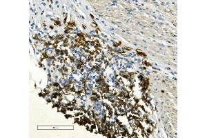 IHC analysis of CD20/MS4A1 using anti-CD20/MS4A1 antibody (ABIN7599233). (CD20 anticorps  (AA 1-297))