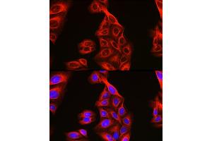 Immunofluorescence analysis of U2OS cells using Alpha-tubulin (ubiquitous) chain antibody (ABIN7271033) at dilution of 1:100. (TUBA1B anticorps  (AA 1-451))