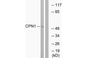 Western Blotting (WB) image for anti-Carboxypeptidase N Subunit 1 (CPN1) (C-Term) antibody (ABIN1851026)