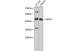 Western blot analysis of extracts of various cell lines, using DPEP1 antibody (ABIN6130950, ABIN6139781, ABIN6139782 and ABIN6221888) at 1:1000 dilution. (DPEP1 anticorps  (AA 17-385))
