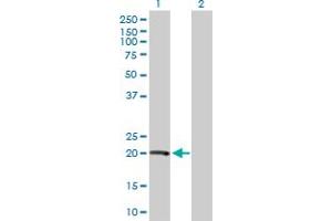 Western Blot analysis of VHL expression in transfected 293T cell line by VHL MaxPab polyclonal antibody.