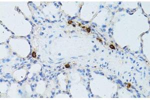Immunohistochemistry of paraffin-embedded Rat lung using TEFM Polyclonal Antibody at dilution of 1:100 (40x lens). (TEFM anticorps)