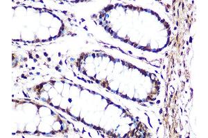 Immunohistochemistry of paraffin-embedded human colon using JNK1/JNK3 Rabbit mAb (ABIN1678909, ABIN7101754, ABIN7101755 and ABIN7101756) at dilution of 1:100 (40x lens). (JNK anticorps)