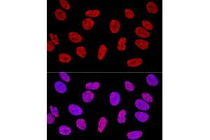 Confocal immunofluorescence analysis of U2OS cells using KHDRBS1/Sam68 Polyclonal Antibody (ABIN6133782, ABIN6142829, ABIN6142830 and ABIN6221707) at dilution of 1:400.