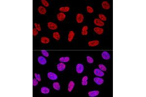 Confocal immunofluorescence analysis of U2OS cells using KHDRBS1/Sam68 Polyclonal Antibody (ABIN6133782, ABIN6142829, ABIN6142830 and ABIN6221707) at dilution of 1:400. (KHDRBS1 anticorps  (C-Term))