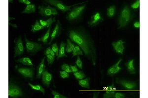 Immunofluorescence of monoclonal antibody to SGK on HeLa cell. (SGK1 anticorps  (AA 1-431))