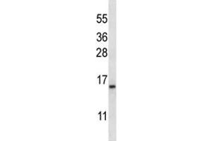 BAFF antibody western blot analysis in K562 lysate. (TNFRSF13C anticorps  (AA 1-30))
