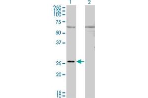 Western Blot analysis of GAP43 expression in transfected 293T cell line by GAP43 monoclonal antibody (M01), clone 3C11. (GAP43 anticorps  (AA 1-238))