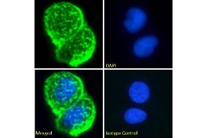 Immunofluorescence staining of fixed MCF7 cells with anti-Breast epithelial mucin antibody Mc5.