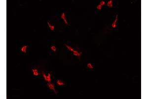 ABIN6266812 staining CACO-2 cells by IF/ICC. (ELF1 anticorps  (C-Term))
