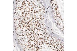 Immunohistochemical staining of human testis with INTS6 polyclonal antibody  shows cytoplasmic positivity in trophoblastic cells at 1:50-1:200 dilution. (INTS6 anticorps)