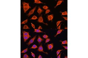 Immunofluorescence analysis of L929 cells using D Rabbit pAb (ABIN6127743, ABIN6139383, ABIN6139384 and ABIN6223348) at dilution of 1:100. (DAAM2 anticorps  (AA 1-86))