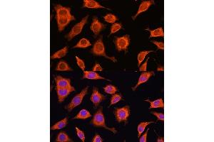 Immunofluorescence analysis of L929 cells using D Rabbit pAb (ABIN6127743, ABIN6139383, ABIN6139384 and ABIN6223348) at dilution of 1:100.