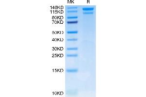 Human LDLR on Tris-Bis PAGE under reduced condition.