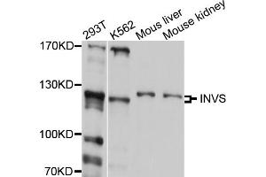 Western blot analysis of extracts of various cell lines, using INVS antibody (ABIN5997996) at 1/1000 dilution. (Inversin anticorps)
