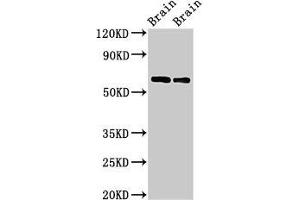 Western Blot Positive WB detected in: Rat brain tissue, Mouse brain tissue All lanes: CPNE4 antibody at 2 μg/mL Secondary Goat polyclonal to rabbit IgG at 1/50000 dilution Predicted band size: 63, 65 kDa Observed band size: 63 kDa (Copine IV anticorps  (AA 1-280))