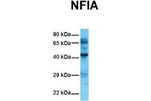 Host:  Rabbit  Target Name:  NFIA  Sample Tissue:  Human Fetal Lung  Antibody Dilution:  1. (NFIA anticorps  (Middle Region))