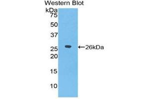 Western Blotting (WB) image for anti-Epiphycan (EPYC) (AA 110-317) antibody (ABIN1858734)