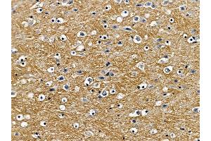 ABIN6257490 and ABIN6275517 at 1/100 staining mouse brain tissue by IHC-P. (SCAMP1 anticorps  (N-Term))