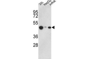 Western Blotting (WB) image for anti-Histone Aminotransferase 1 (HAT1) antibody (ABIN2995847) (HAT1 anticorps)