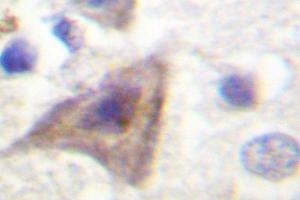 Image no. 1 for anti-AKT1 Substrate 1 (Proline-Rich) (AKT1S1) antibody (ABIN271990) (PRAS40 anticorps)