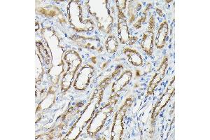 Immunohistochemistry of paraffin-embedded Rat kidney using CALCA antibody (ABIN7266005) at dilution of 1:100 (40x lens). (CGRP anticorps  (AA 1-141))